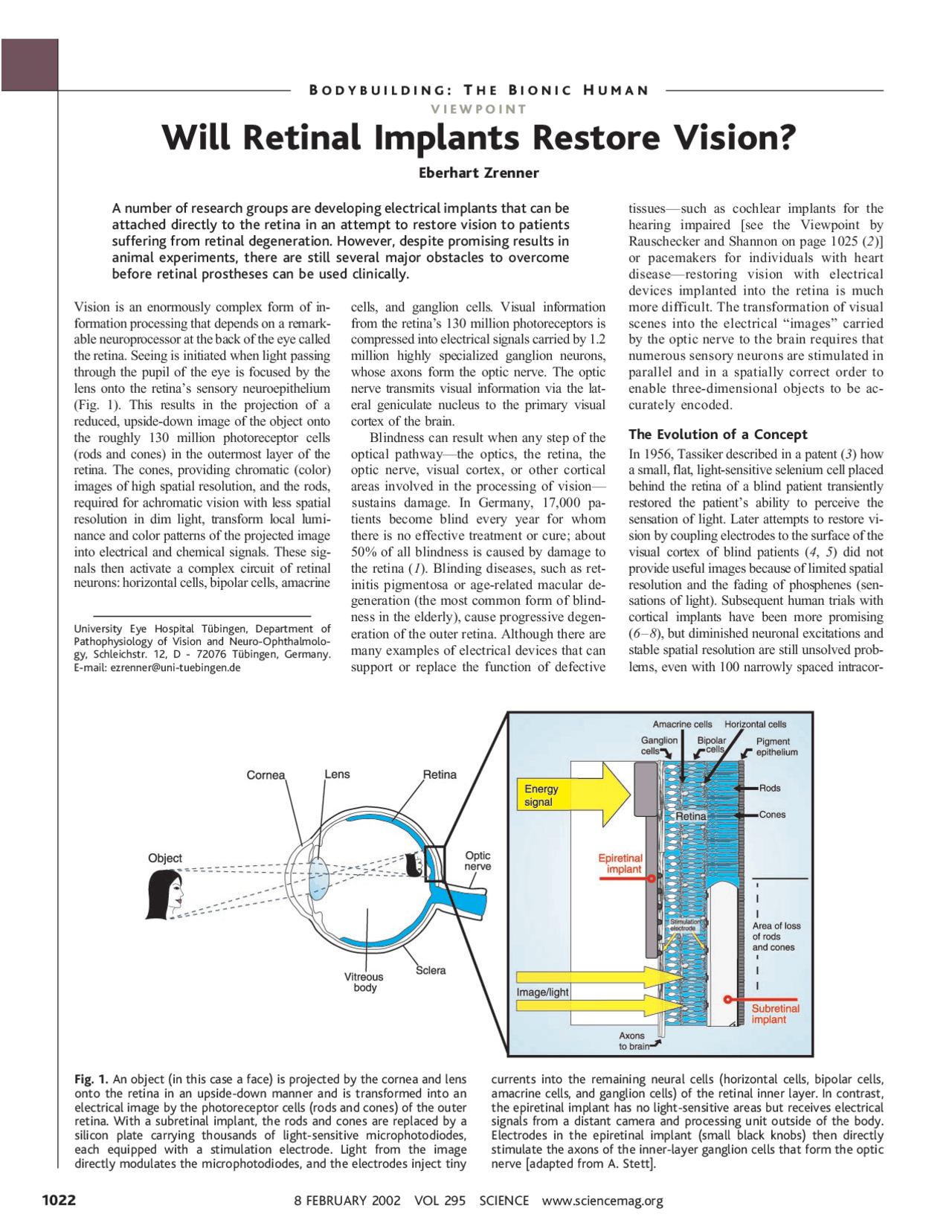 How Do Retinal Implants Restore Vision? – VLFG