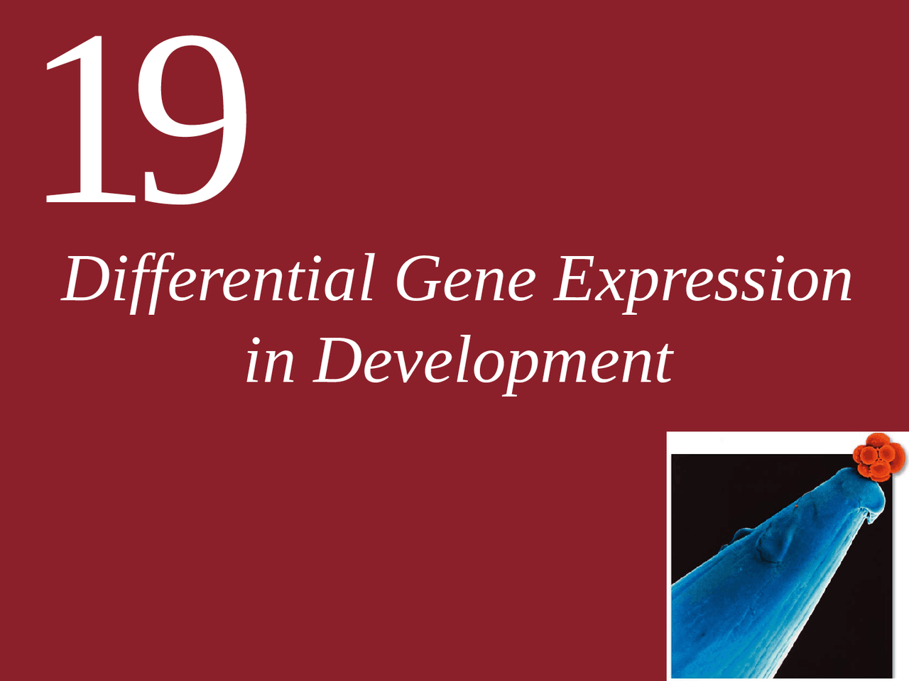 Differential Gene Expression in Development Lecture Slides BIOL