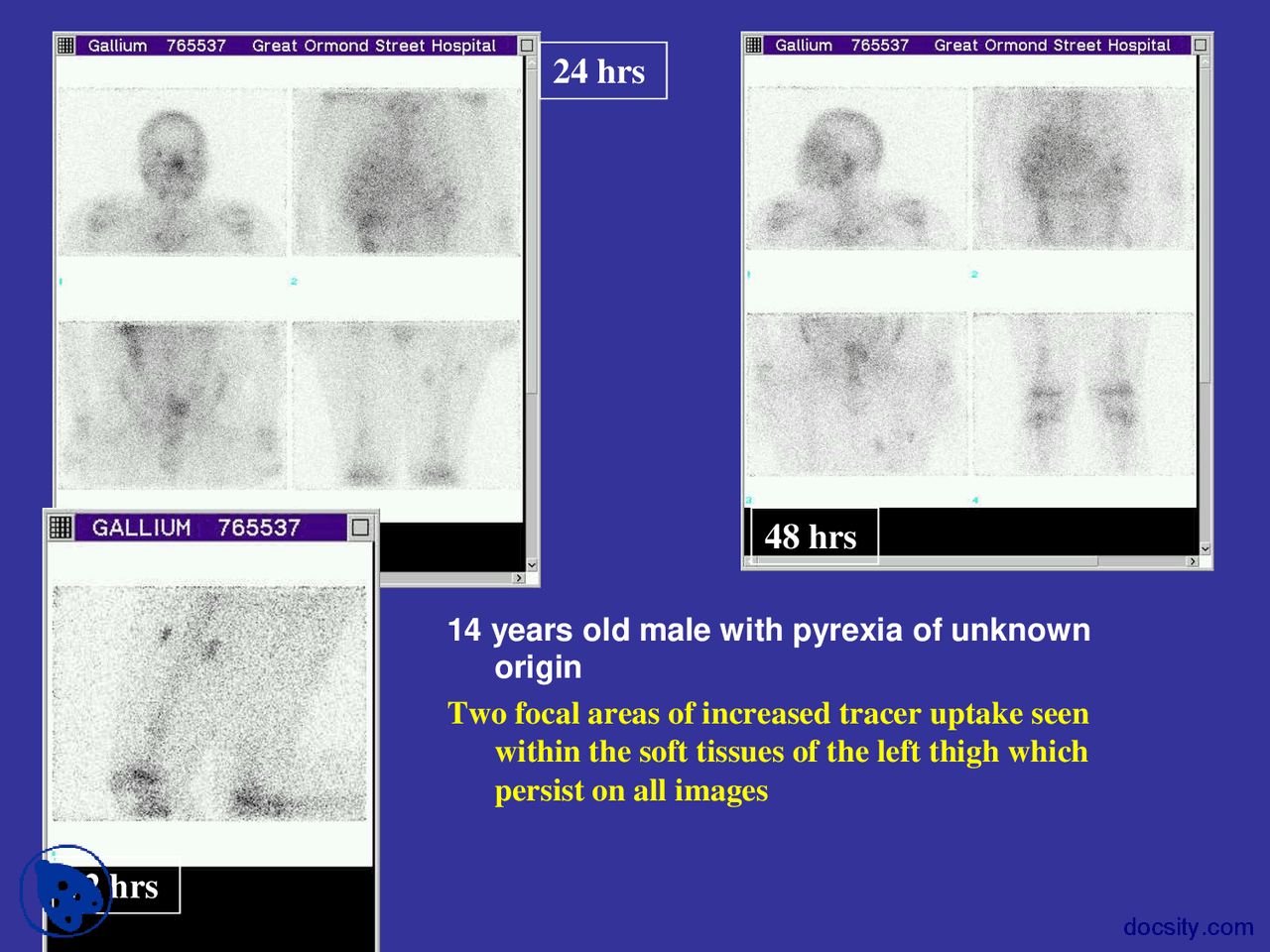 Bone Scans Bones Lecture Slides Docsity Bone Scans Bones Lecture Slides Docsity
