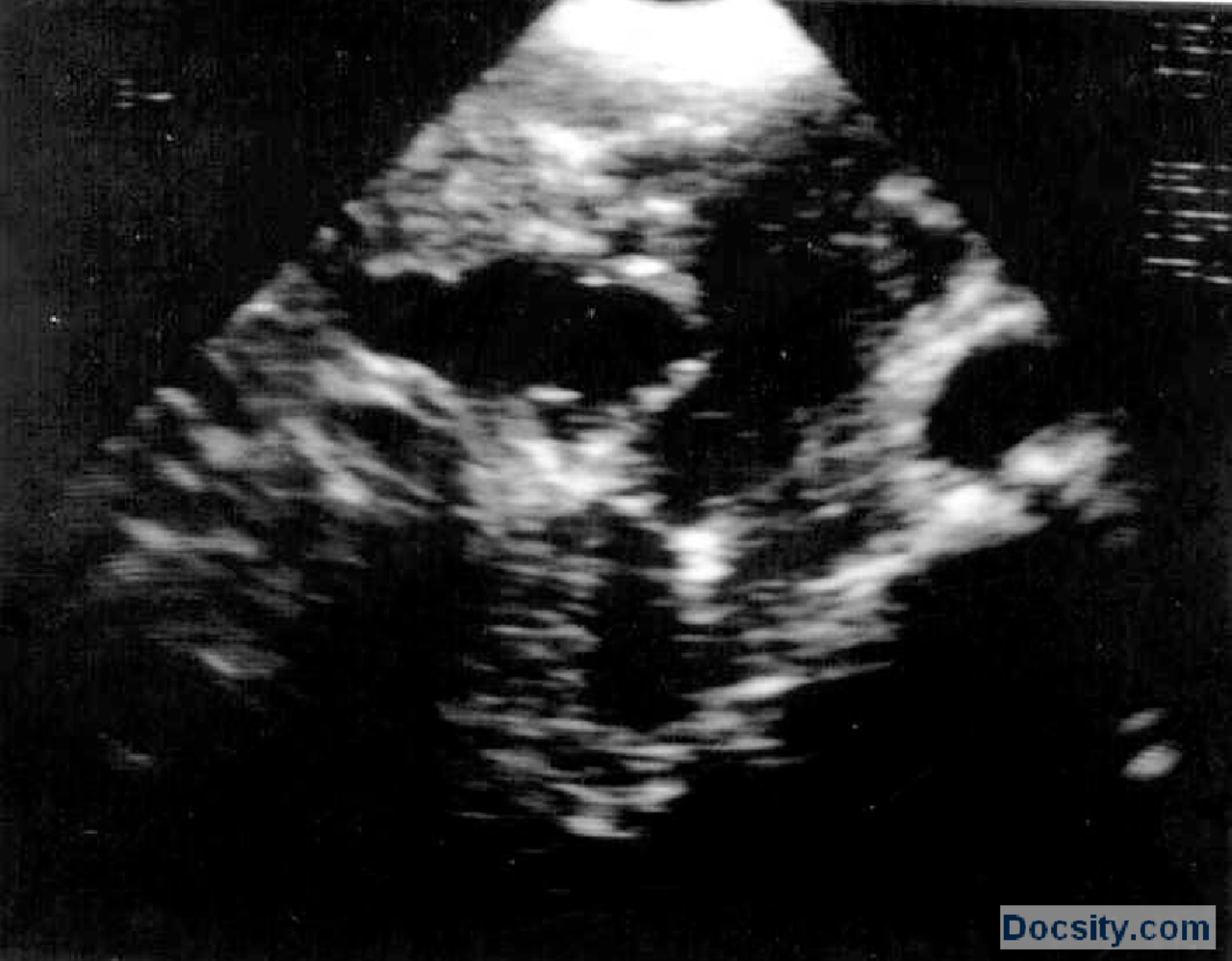 Ultrazvuk snimciVezbeRadiologijaMedicina 6 Vežbe' predlog Radiologija Docsity