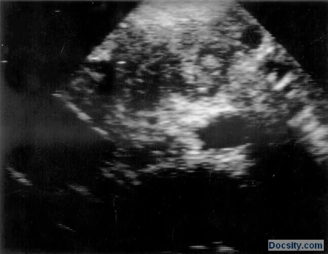 Ultrazvuk snimciVezbeRadiologijaMedicina 2 Vežbe' predlog Radiologija Docsity