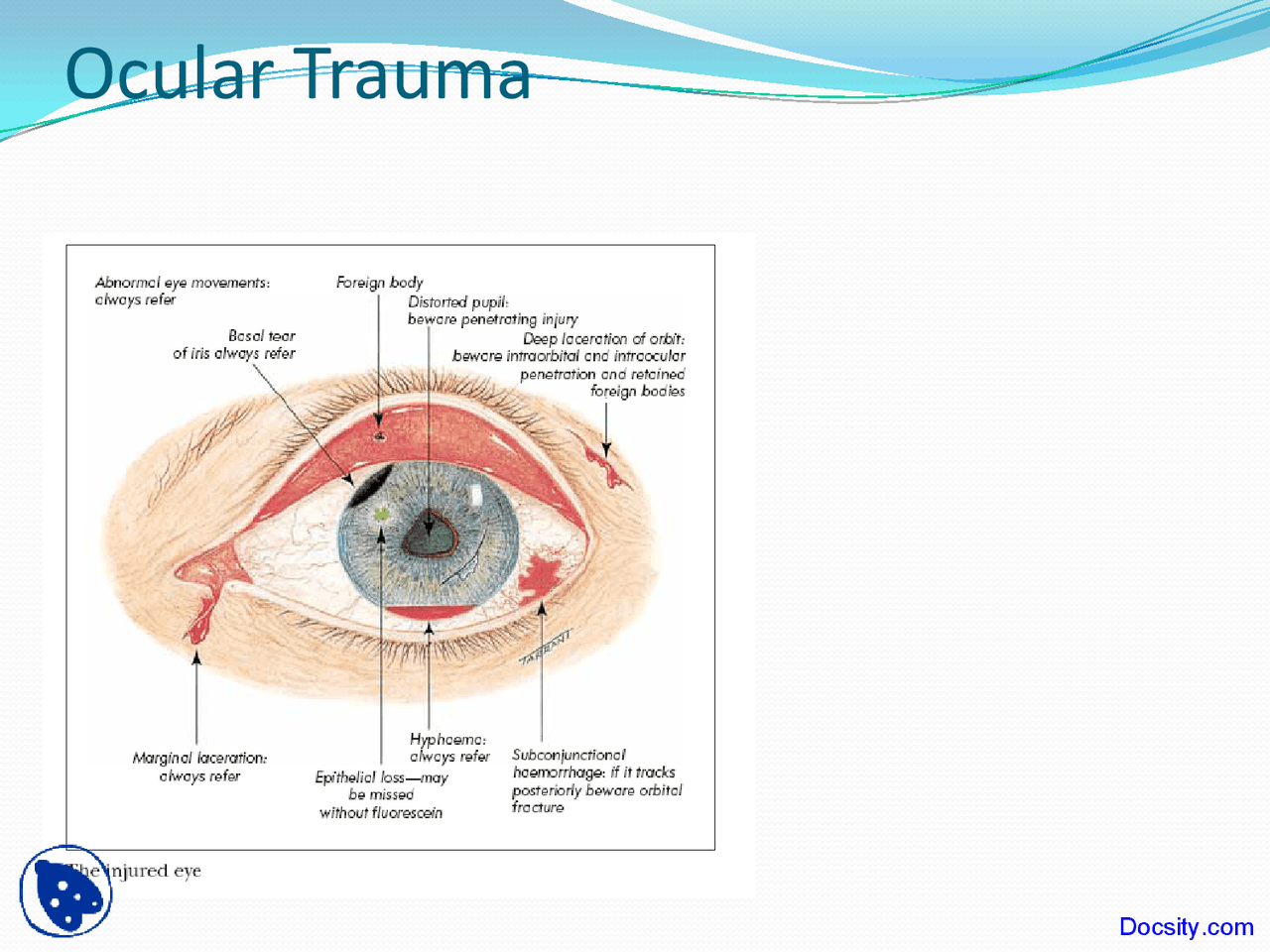 Introduction to Ocular Trauma - Introduction to Ophthalmology - Lecture ...