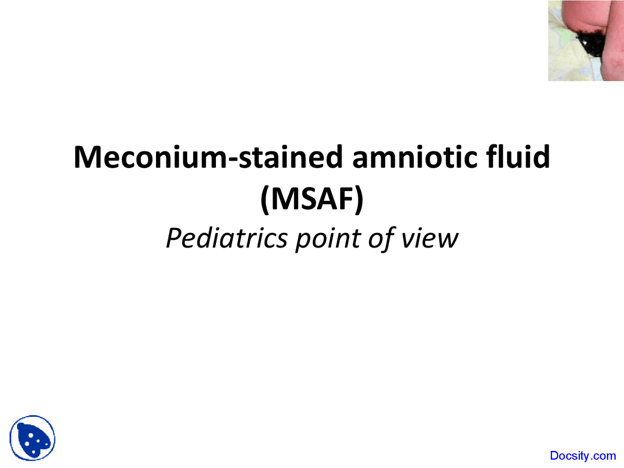 Meconium Stained Amniotic Fluid Neonatology Lecture Slides Docsity