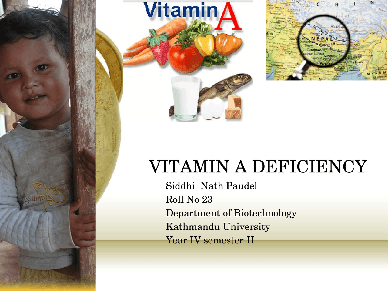 Vitamin a deficiency - Docsity