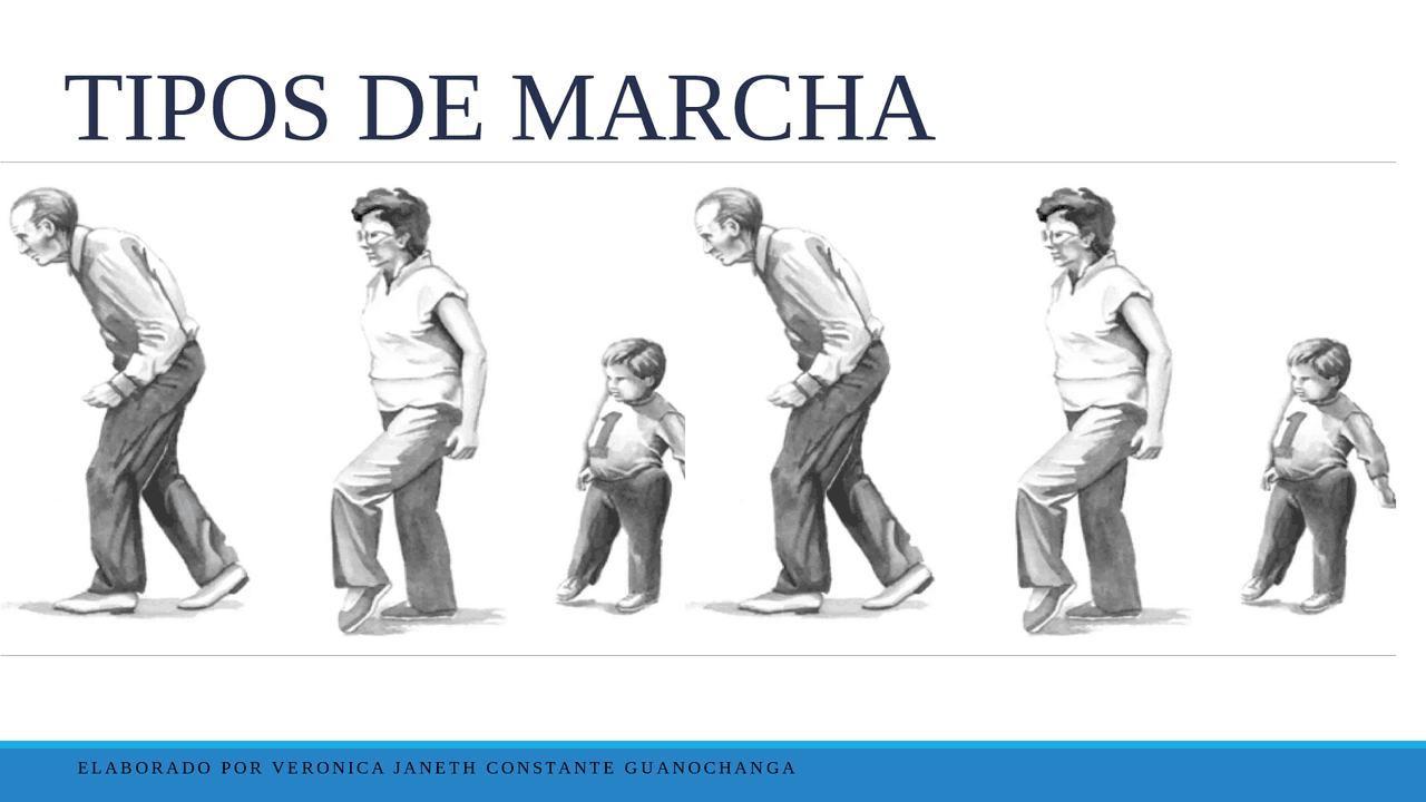 ¿Que es la marcha? TIPOS DE MARCHA, Eubasia, Disbasias patológicas