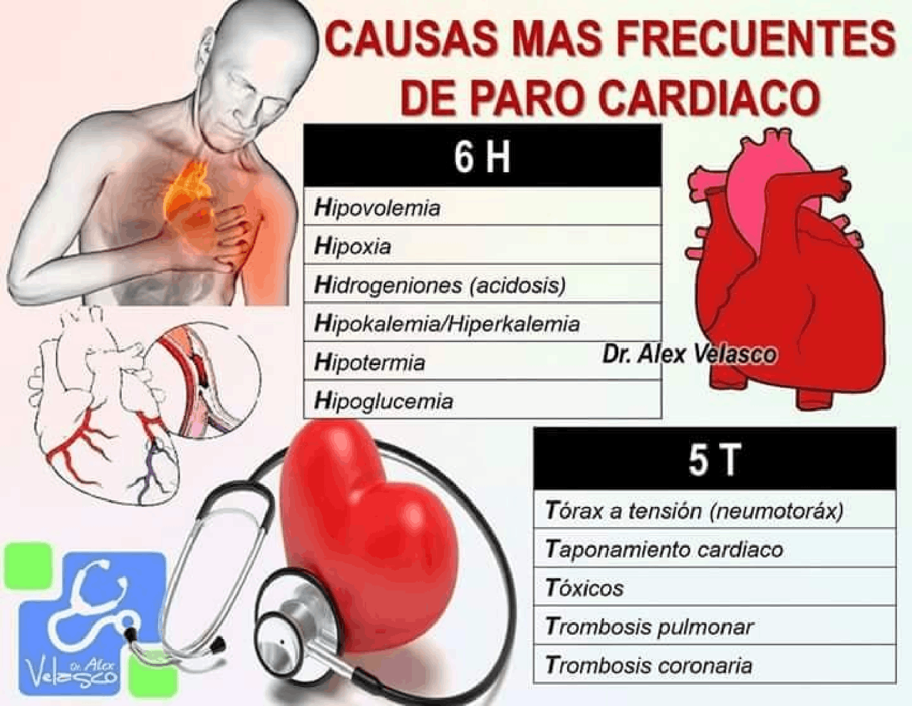 CAUSAS PARO CARDIACO Esquemas Y Mapas Conceptuales De Cardiolog a causas-paro-cardiaco-esquemas-y-mapas-conceptuales-de-cardiolog-a