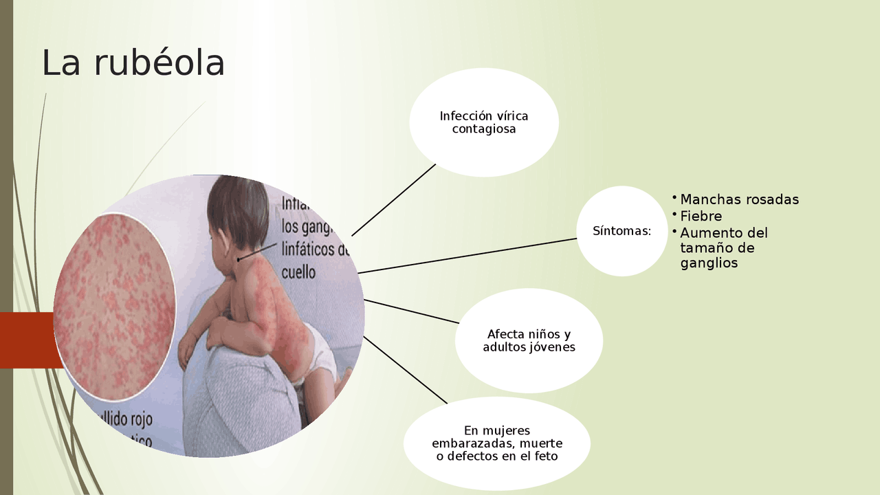 Cadena epidemiologica de la rubeola - Docsity