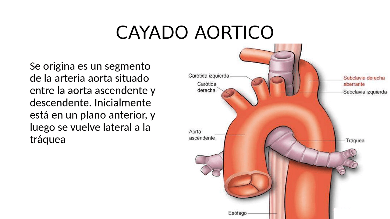 CAYADO AORTICOSe Origina Es Un Segmento De La Arteria Aorta Situado cayado-aorticose-origina-es-un-segmento-de-la-arteria-aorta-situado