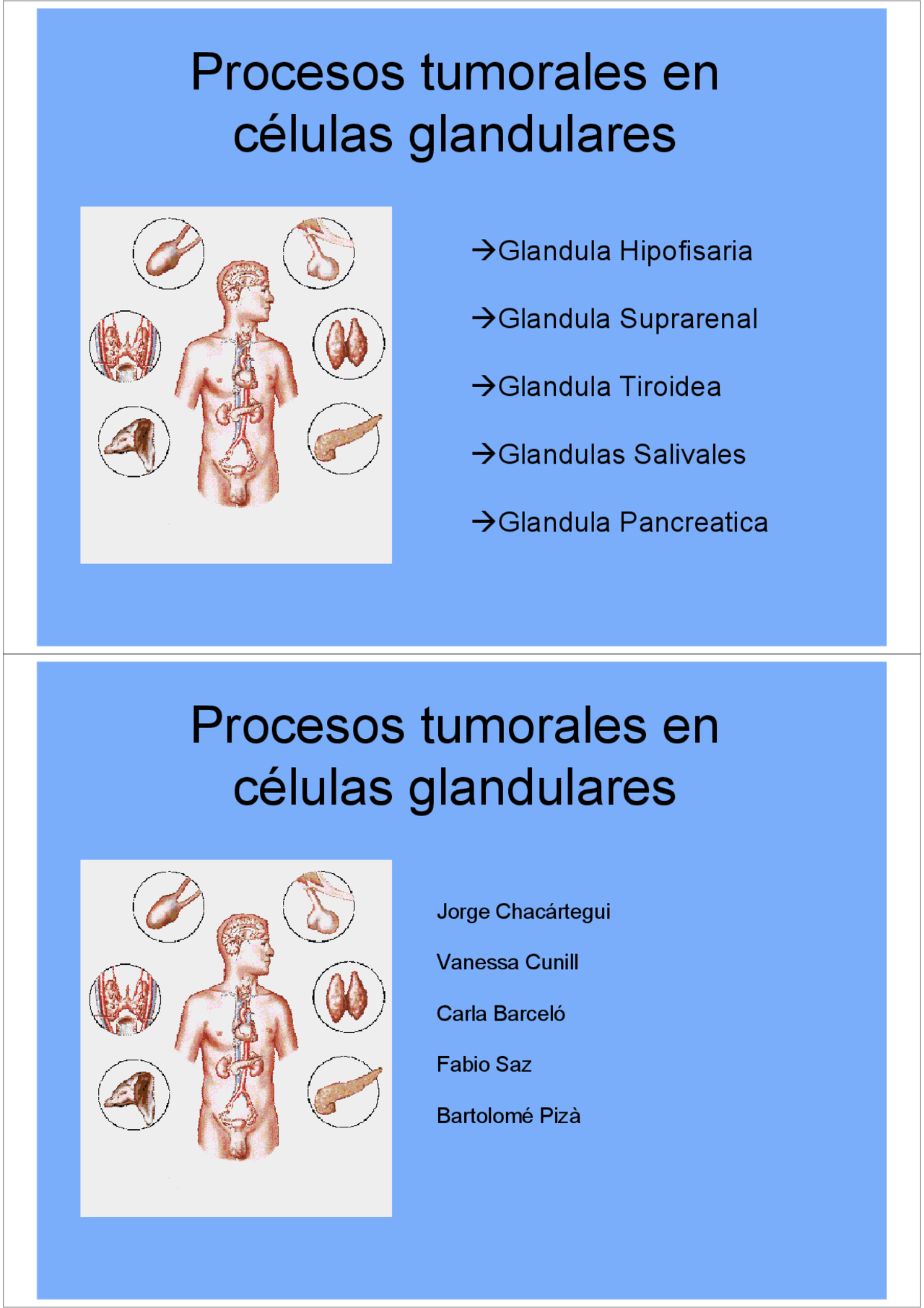 Cáncer glandular. Aspectos Docsity
