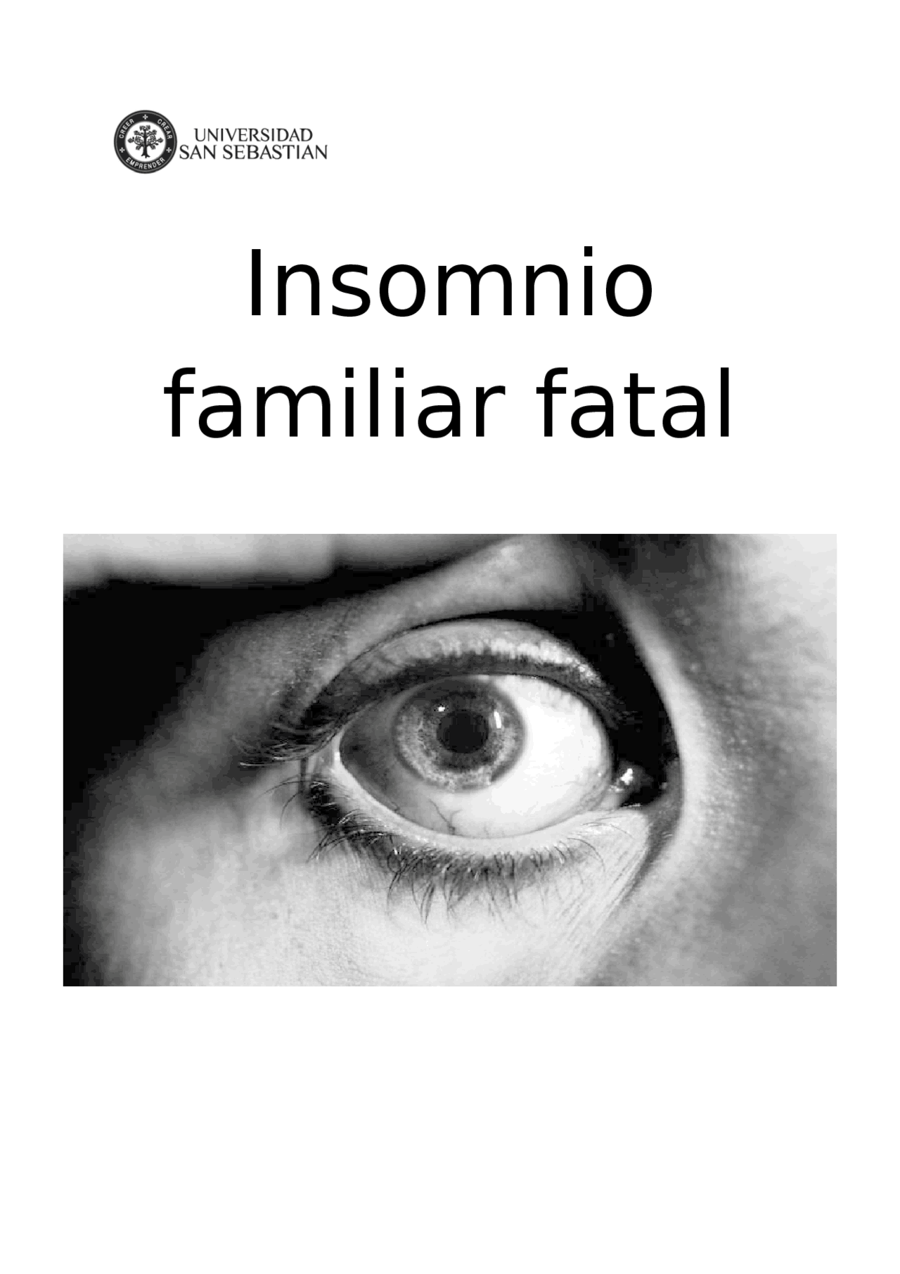 Insomnio familiar fatal - Docsity