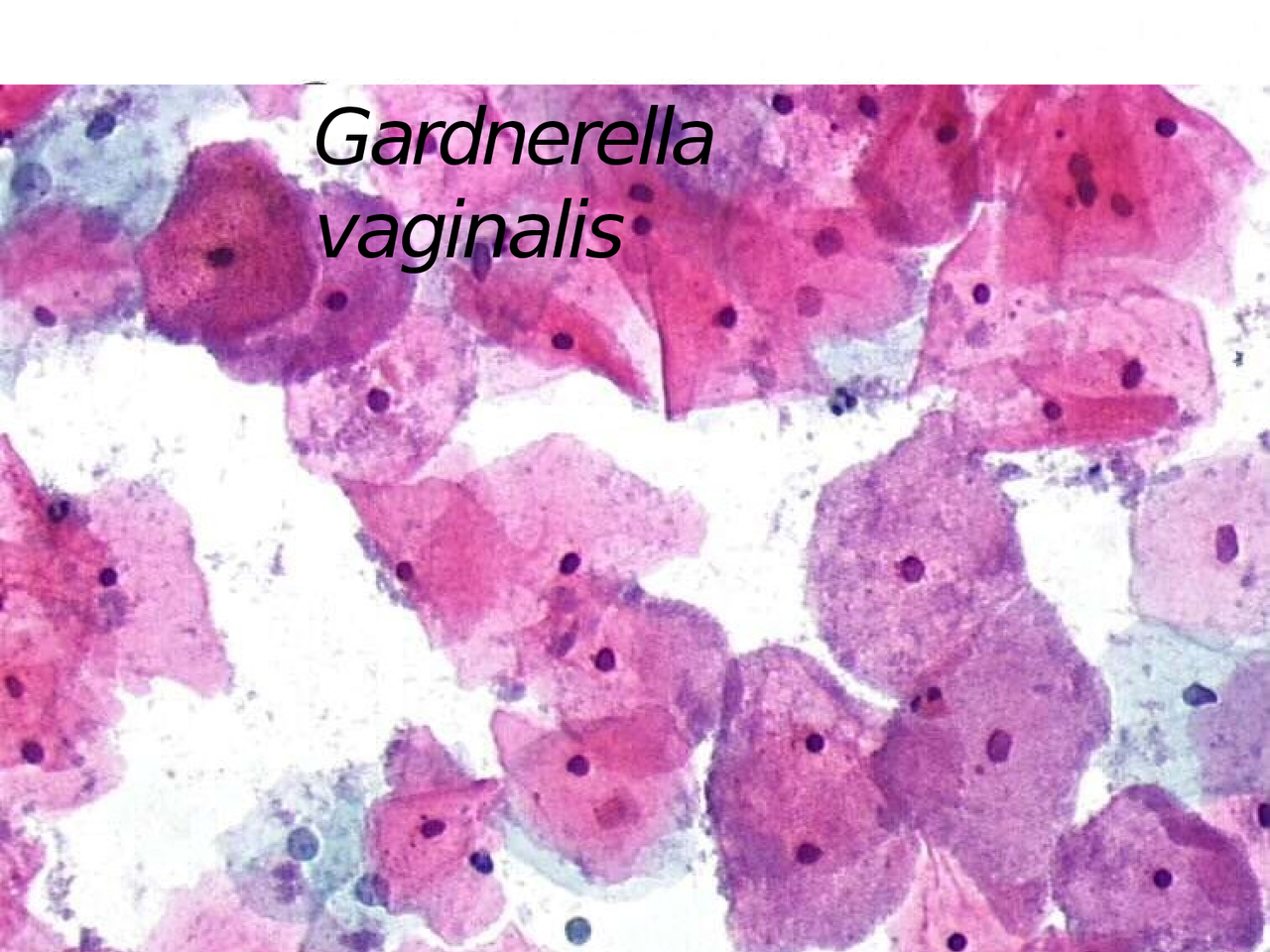 Gardnerella vaginalis. - Docsity