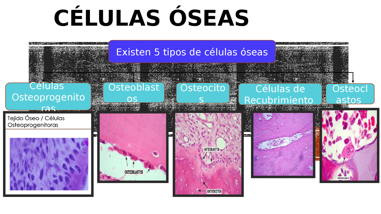 Células óseas Diapositivas | Diapositivas de Anatomía | Docsity
