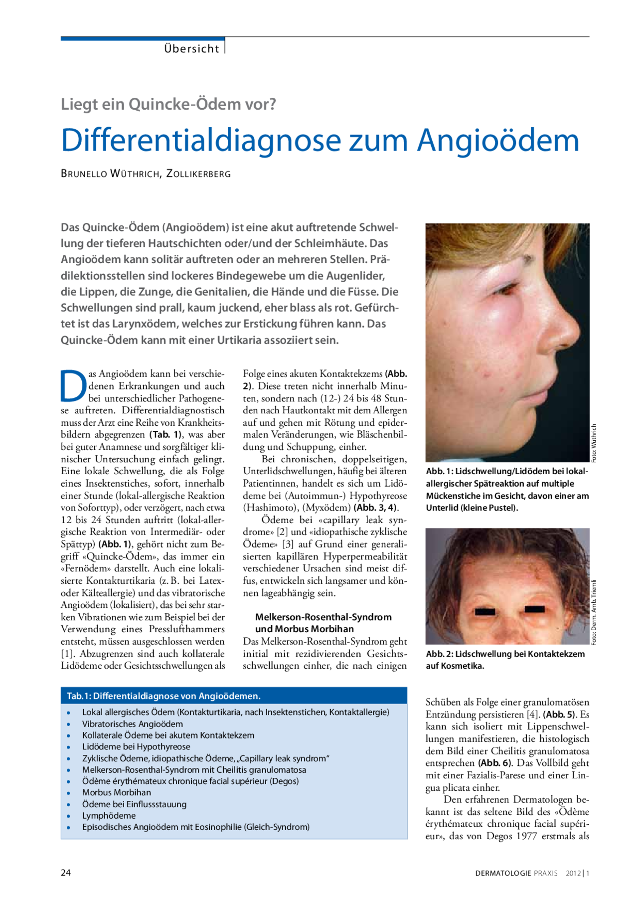 Differentialdiagnose Zum Angio dem Liegt Ein Quincke dem Vor Docsity differentialdiagnose-zum-angio-dem-liegt-ein-quincke-dem-vor-docsity
