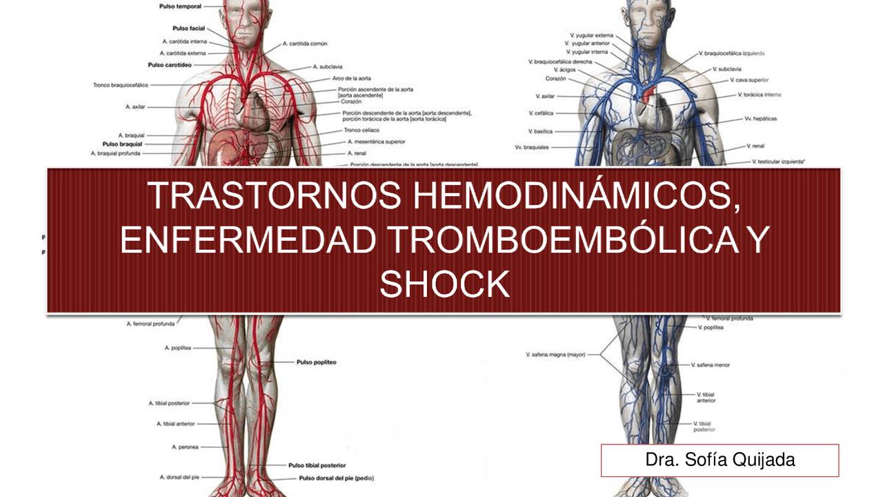 TRASTORNOS HEMODINÁMICOS, ENFERMEDAD TROMBOEMBÓLICA Y SHOCK. - Docsity