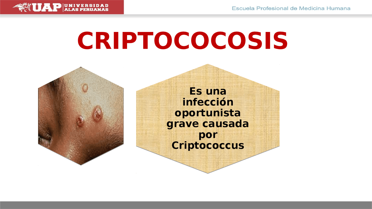 CRIPTOCOCSIS Y CANDIDIASIS - Docsity