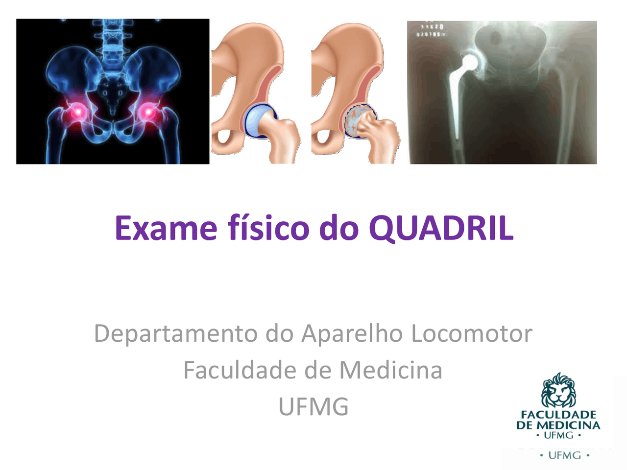 Testes Ortopédicos Do Quadril _ Teste FADER / Teste FADER-R – XIJMH