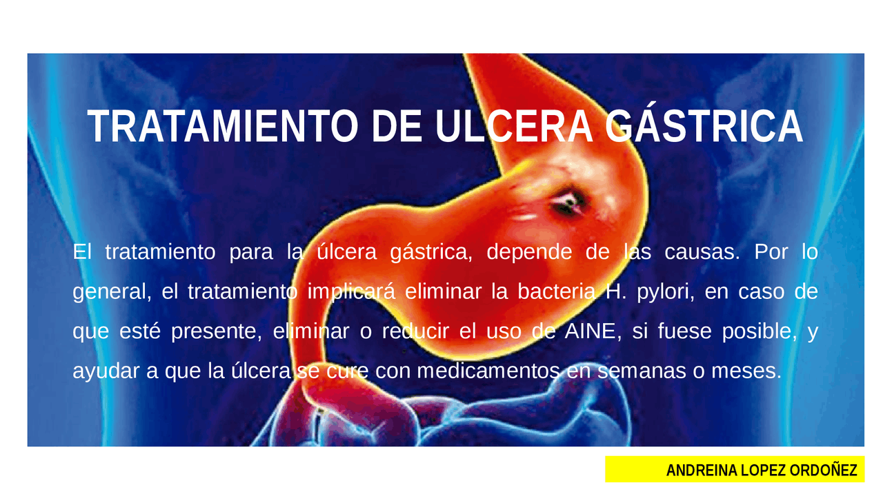 TRATAMIENTO ULCERA GASTRICA | Diapositivas de Gastroenterología - Docsity