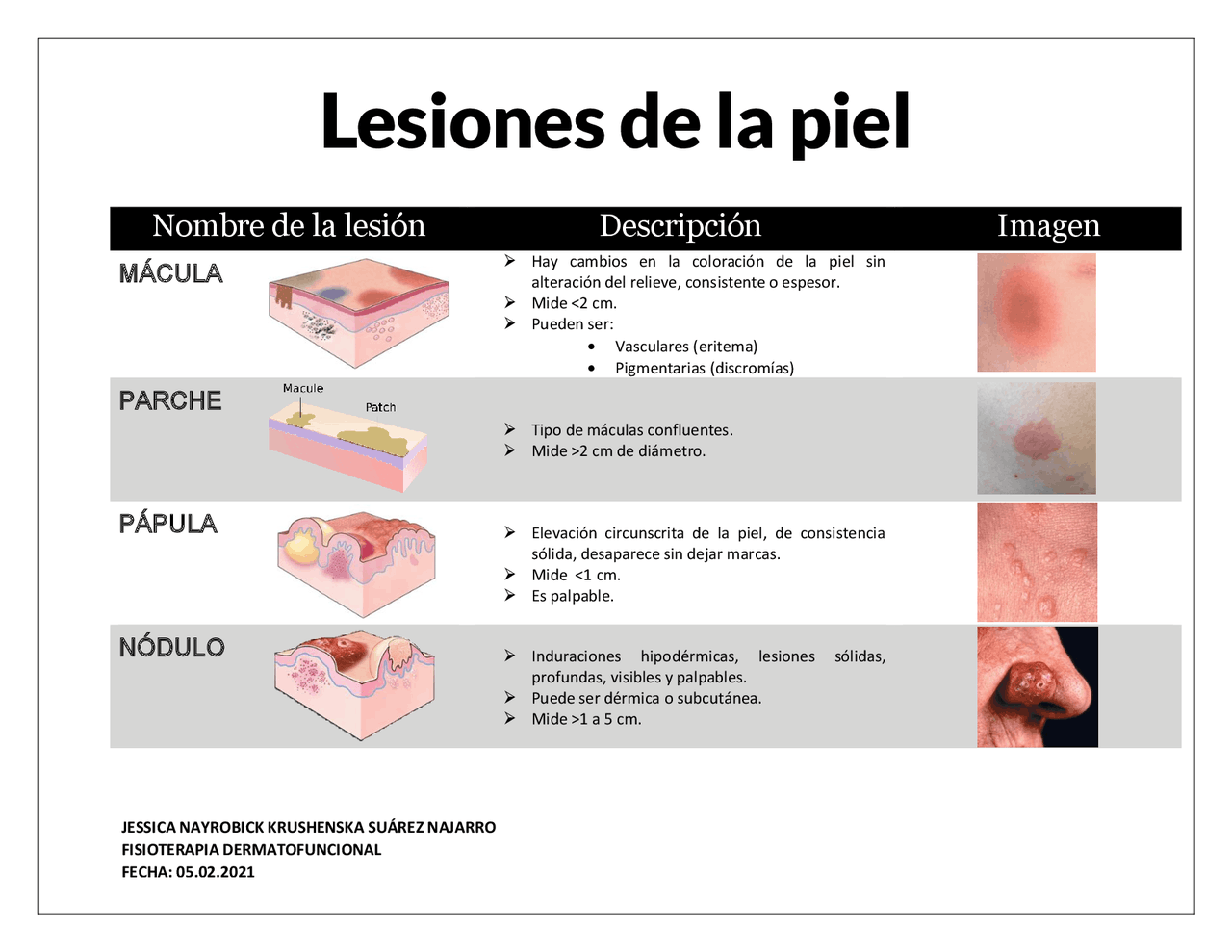 Lesiones en la piel, como tratarlo - Docsity