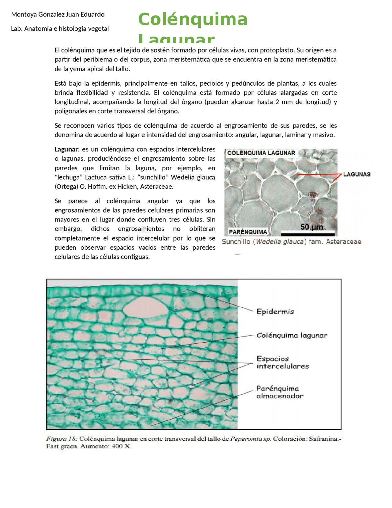 Tejido Colenquima lagunar | Apuntes de Biología - Docsity