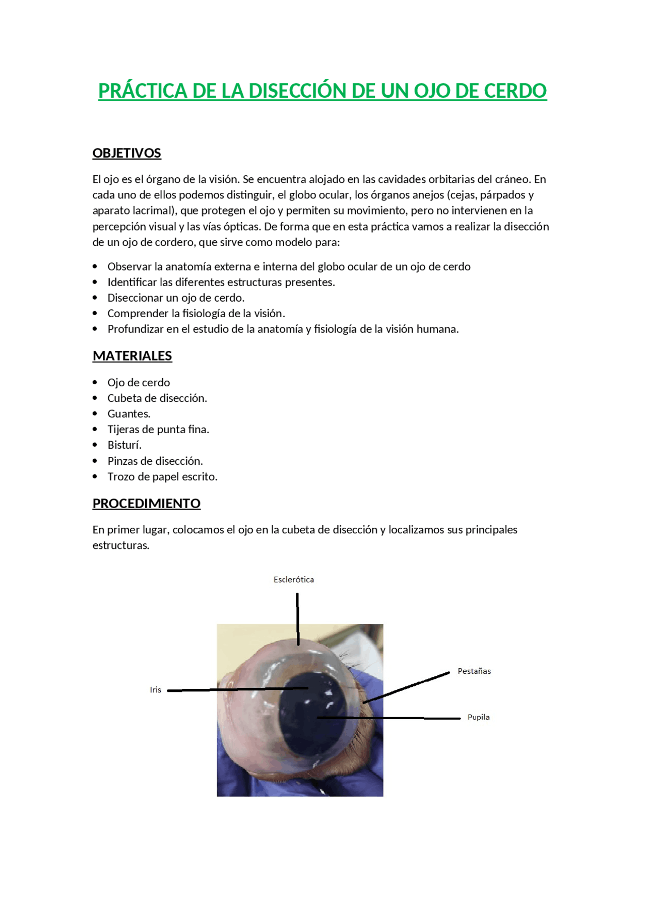 DISECCION DE UN OJO De Cordero Ejercicios De Anatom a Aplicada Docsity diseccion-de-un-ojo-de-cordero-ejercicios-de-anatom-a-aplicada-docsity