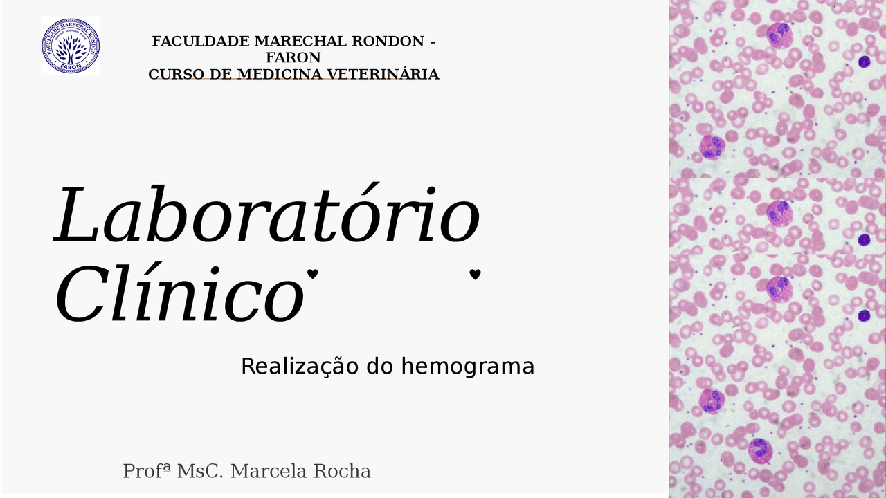 Aula interpretação de leucograma - Docsity