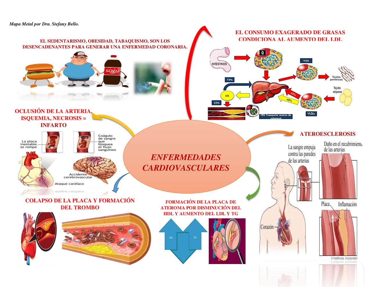 MAPA MENTAL DE ENFERMEDADES CARDIOVASCULARES | Esquemas y mapas