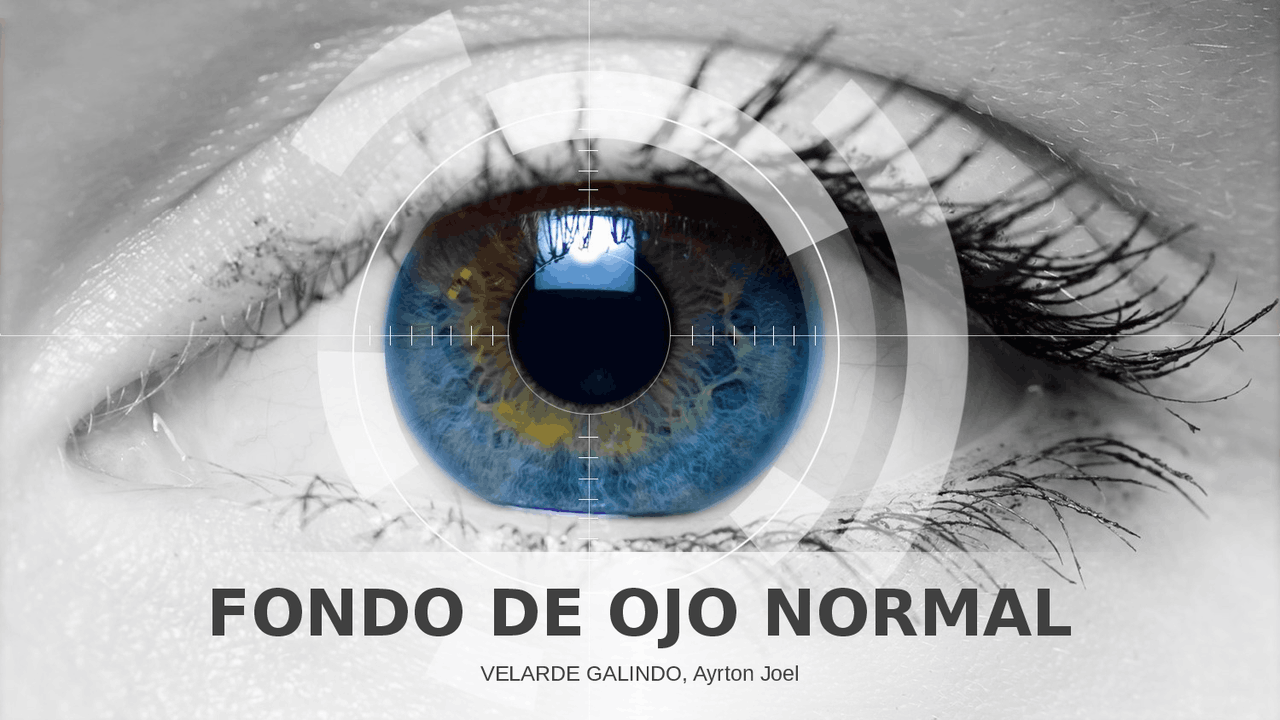FONDO DE OJO NORMAL diapositivas Docsity