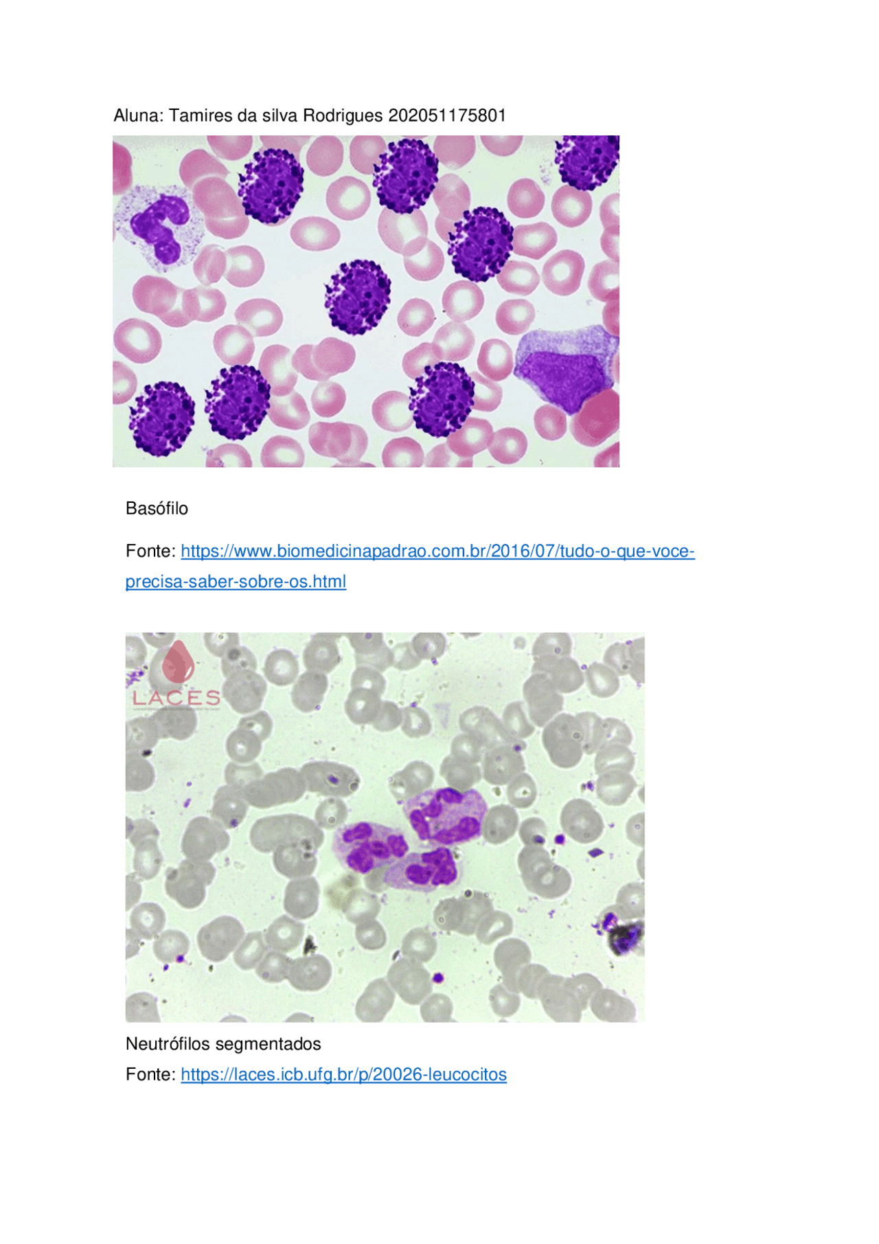 Leucocitos Alto No Hemograma - NAZAEDU