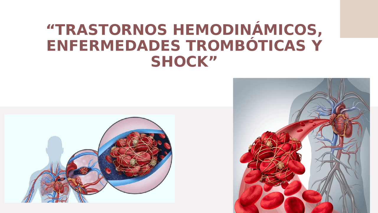 Trastornos Hemodinámicos Enfermedad Tromboembólica Y Shock