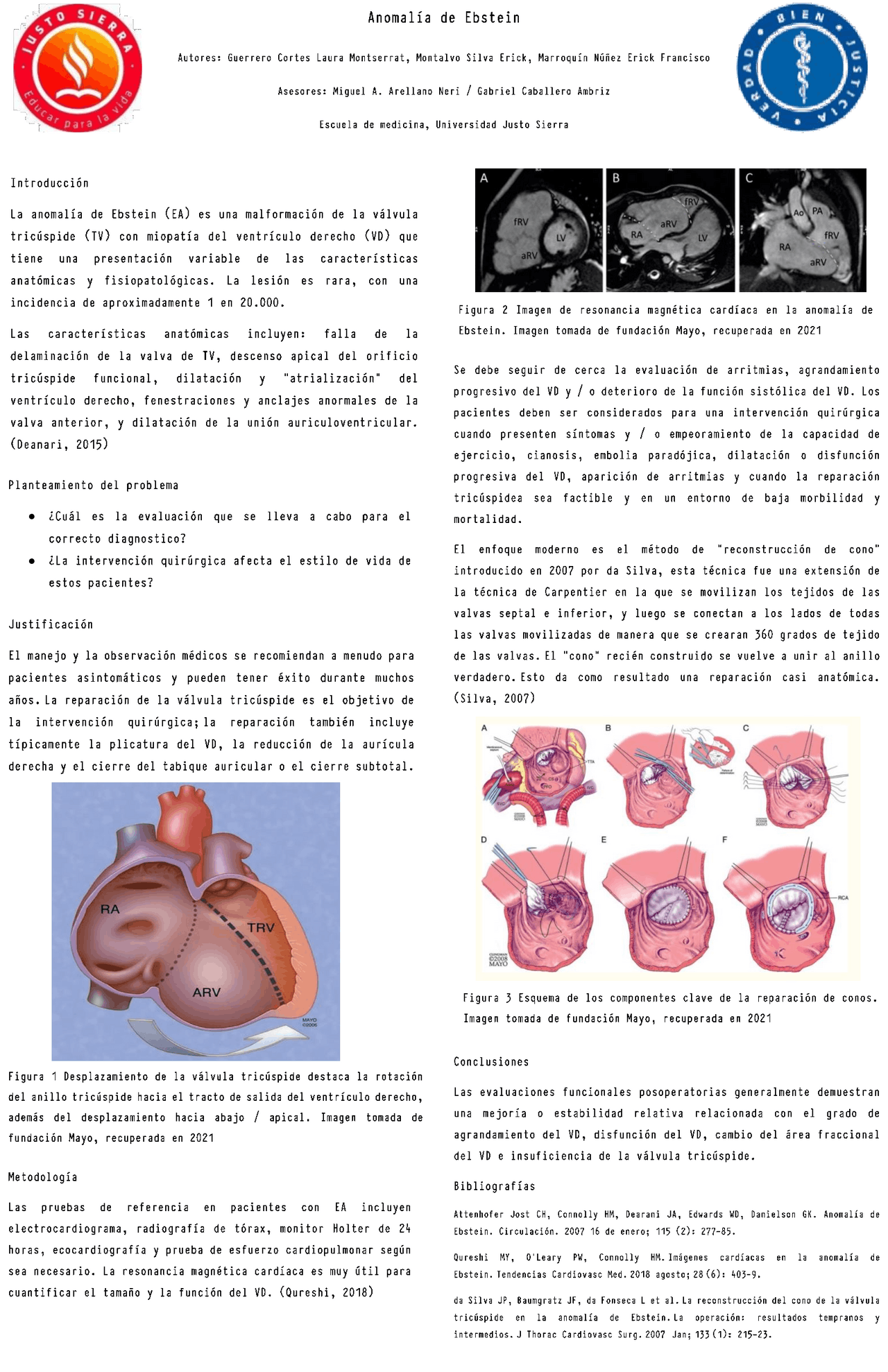 Anomalia De Ebstein Tem Cura - RETOEDU