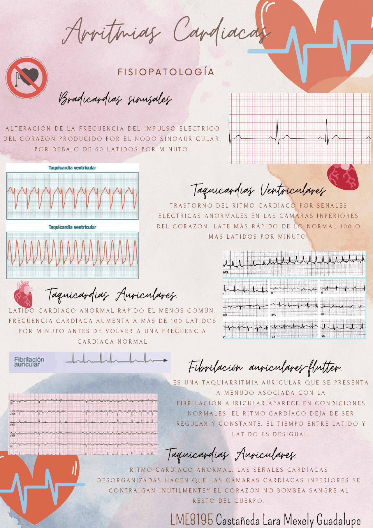Arritmias Cardiacas Y Tipos Apuntes De Fisiopatología Docsity Arritmias Cardiacas Y Tipos Apuntes De Fisiopatología Docsity