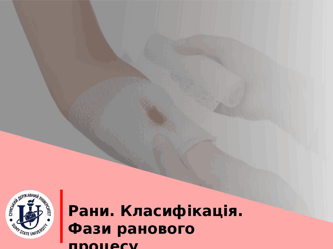 Рани та їх класифікація - Docsity