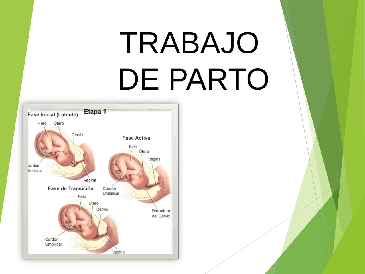 Etapas del Trabajo de Parto - Docsity
