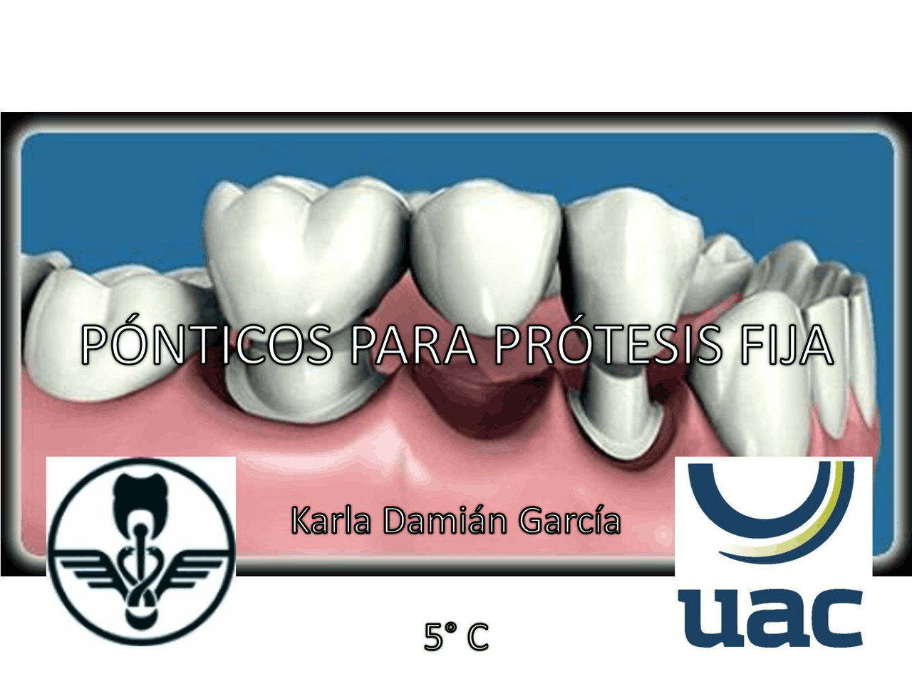 Tipos De Ponticos En Protesis Fija