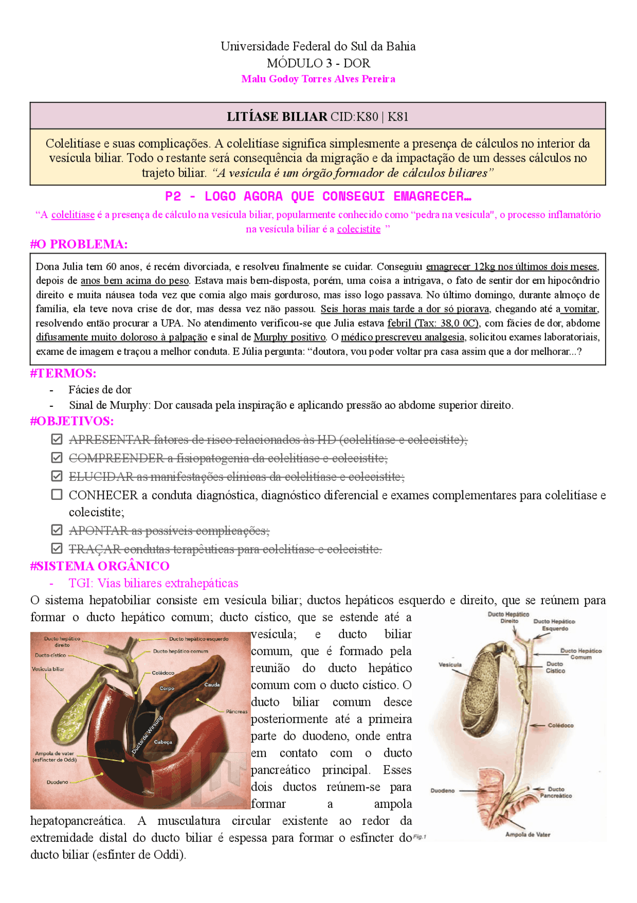 Litiase biliar CID K81|80 | Notas de estudo Cirurgia Geral | Docsity