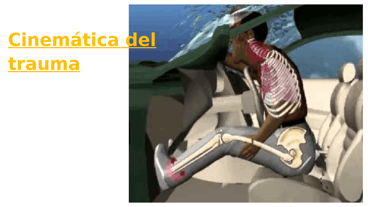 Cinemática del trauma | Diapositivas de Enfermería | Docsity