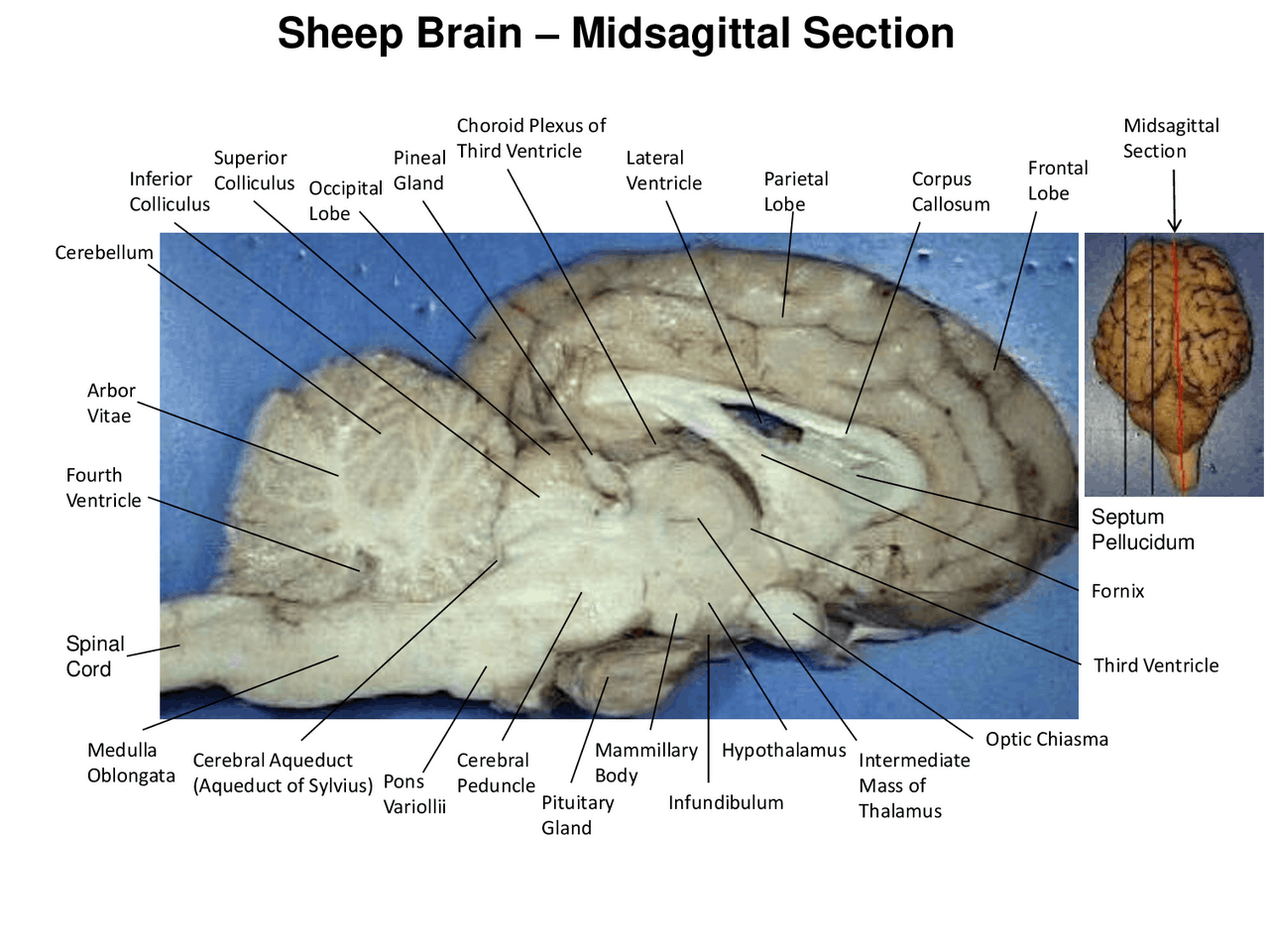 Sheep Brain – Midsagittal Section | Schemes and Mind Maps Animal ...