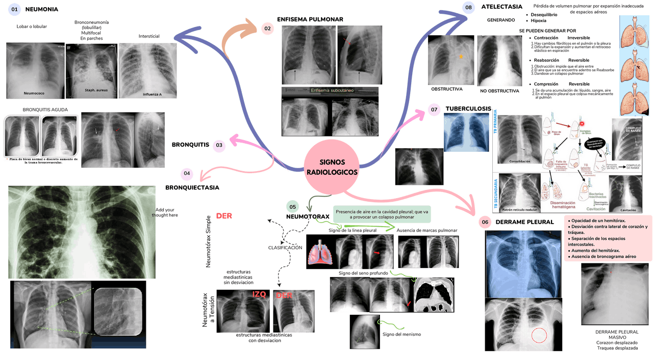 SIGNOS RADIOLOGICOS-DIAGNOSTICO POR IMAGENES | Esquemas y mapas ...