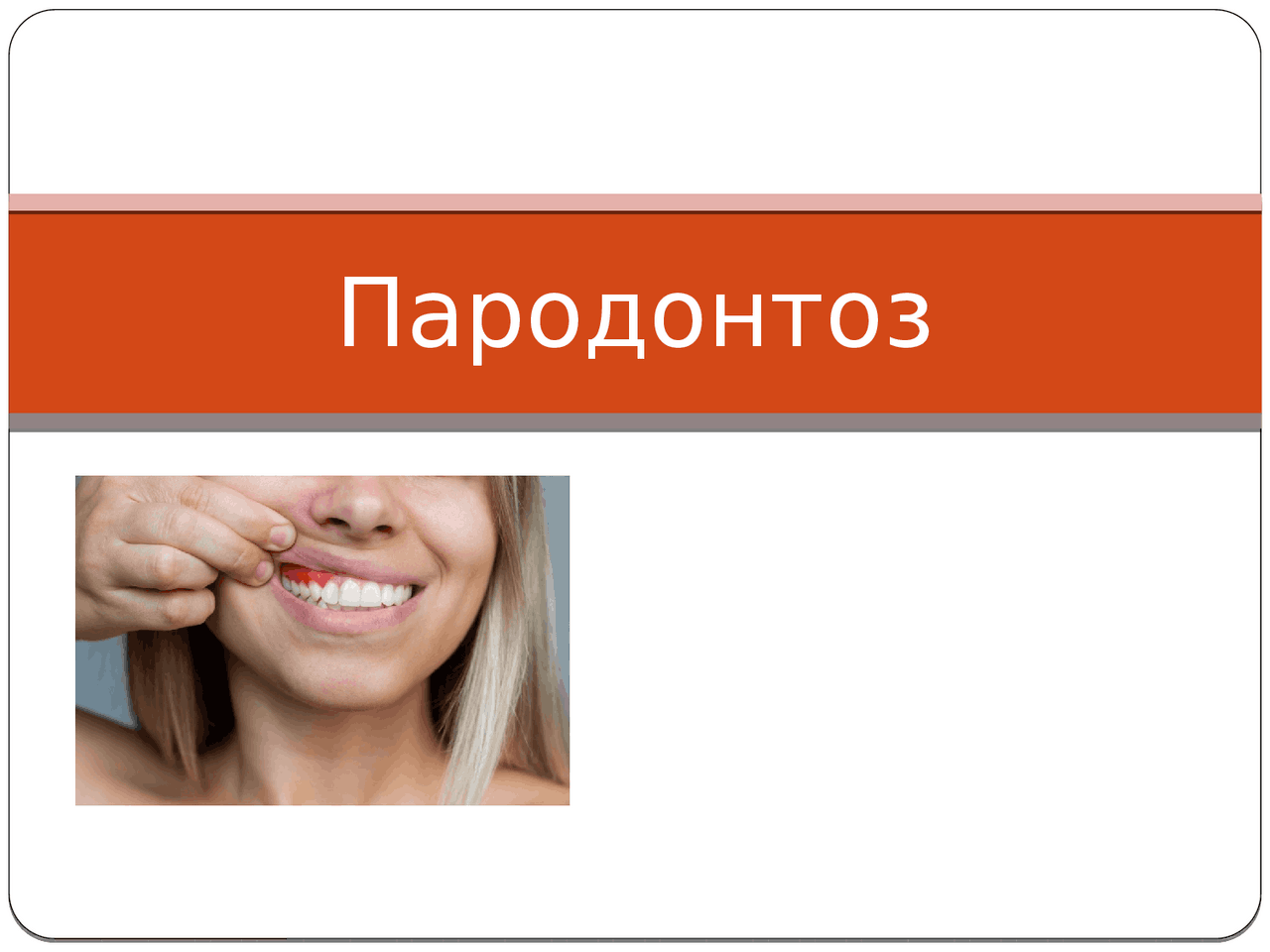 Пародонтоз - симптомы и лечение | Презентации Стоматология | Docsity