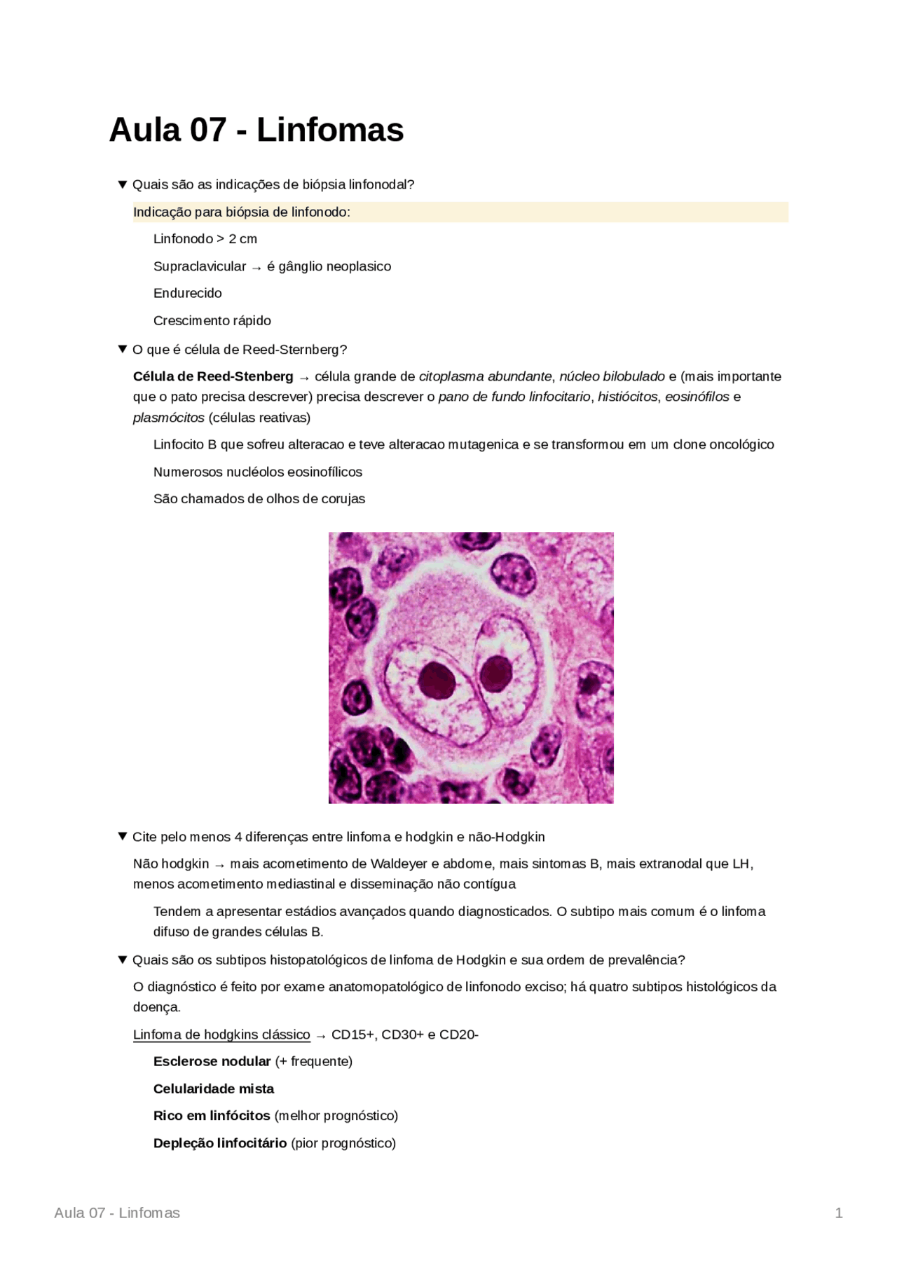 Linfomas Resumo de Hematologia (Flashcards) Resumos Hematologia Docsity
