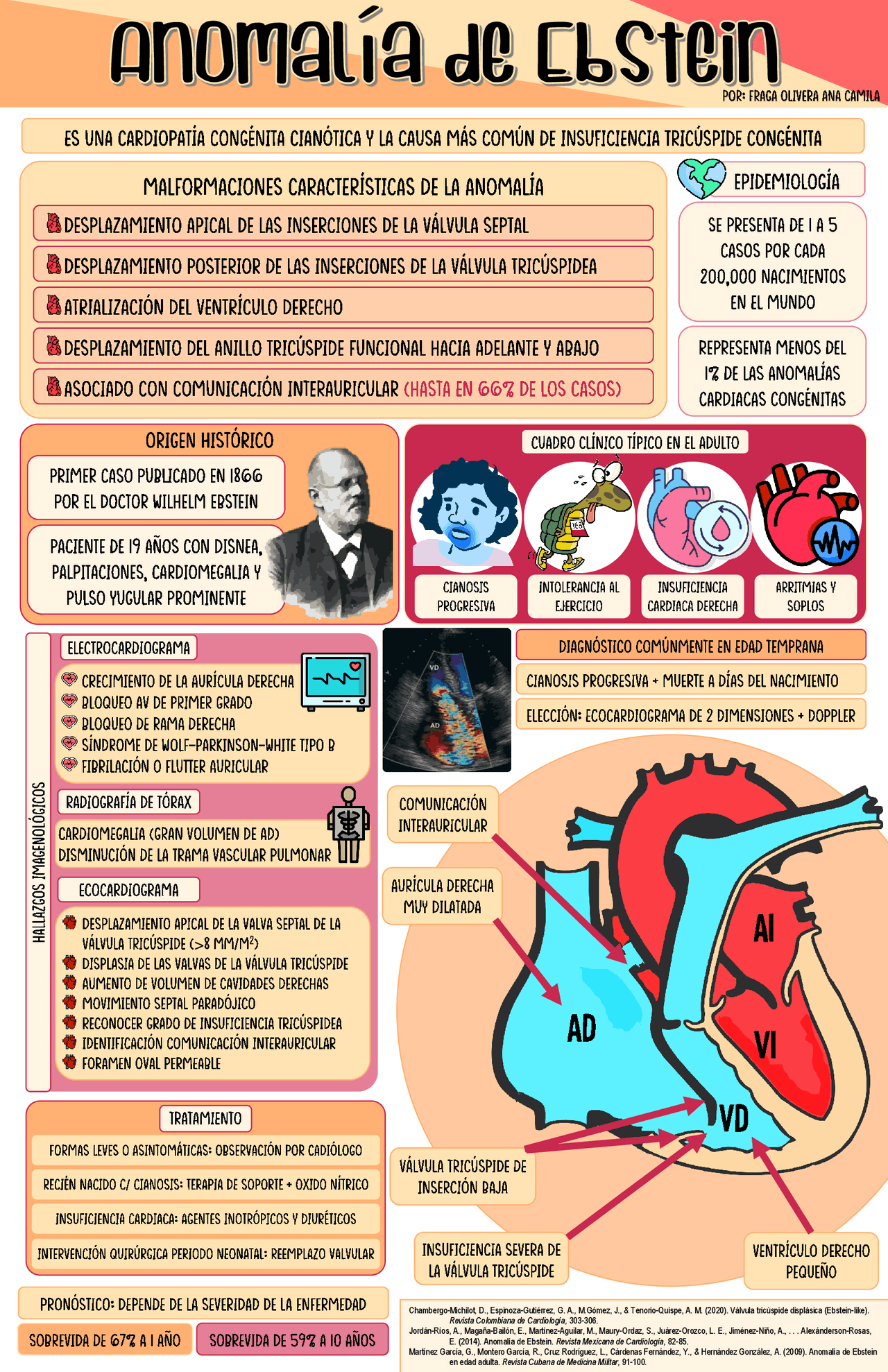 Infografía sobre la Anomalía de Ebstein | Esquemas y mapas conceptuales ...