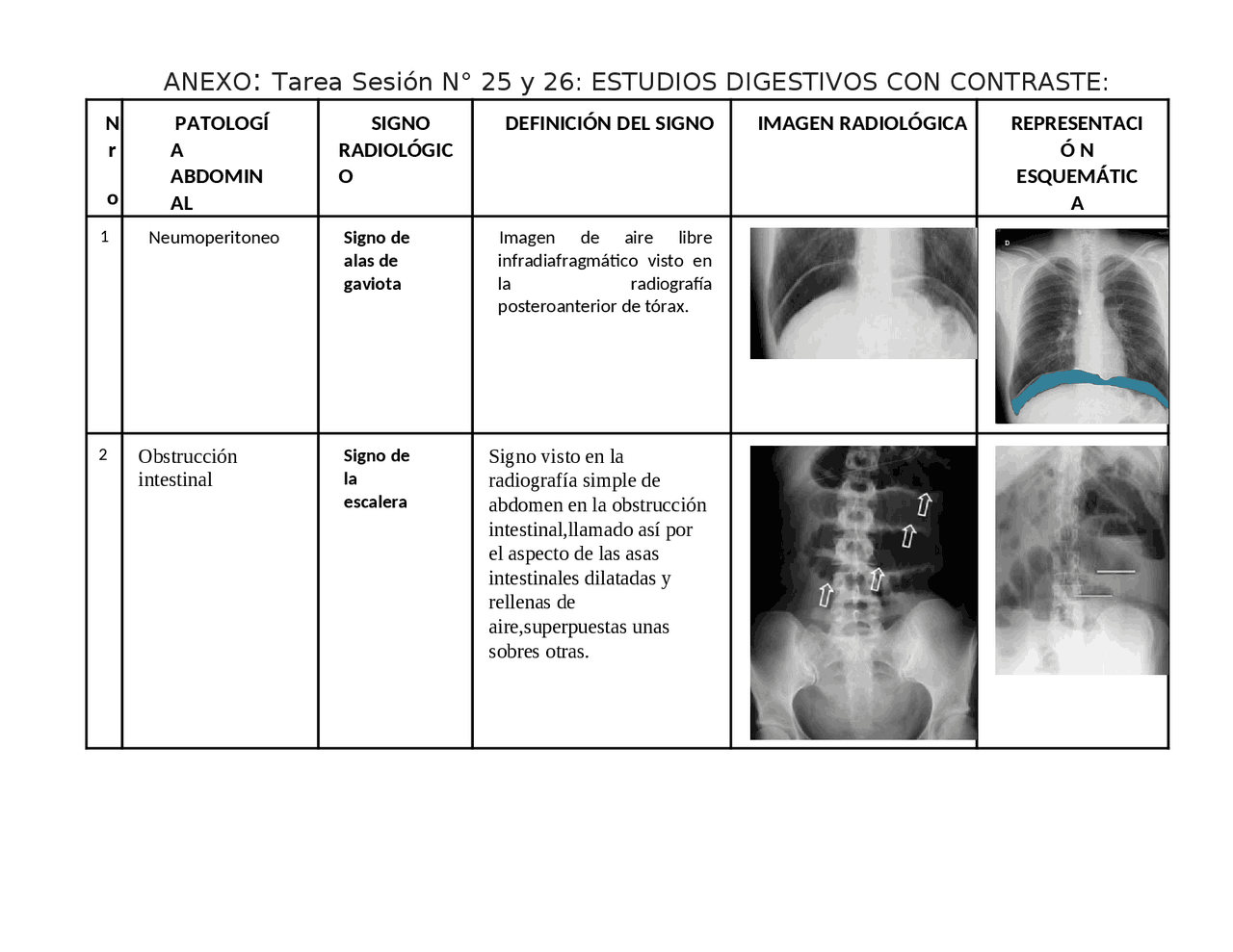 Signos radiologicos del abdomen | Ejercicios de Imagenología | Docsity