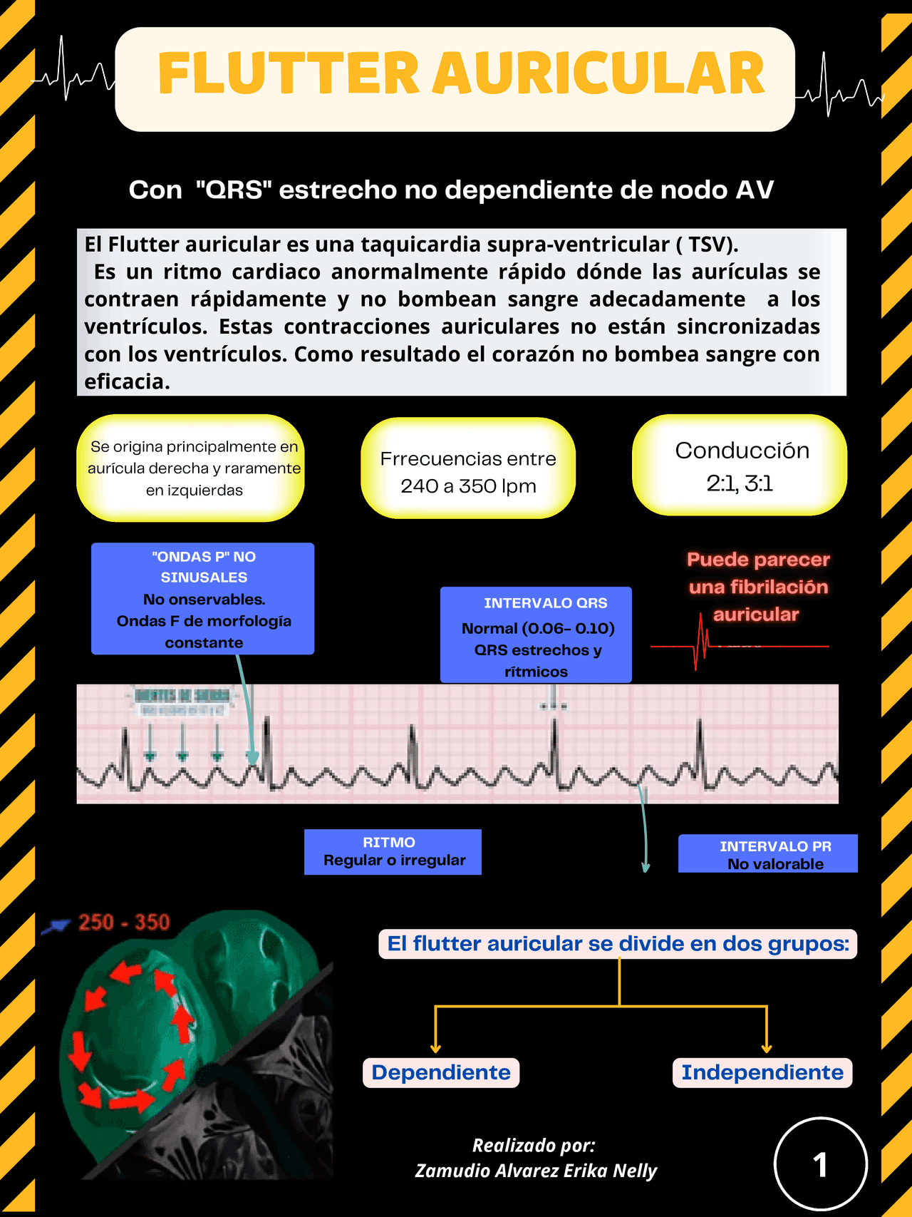 INFOGRAF A FLUTTER AURICULAR Apuntes De Cardiolog a Docsity infograf-a-flutter-auricular-apuntes-de-cardiolog-a-docsity