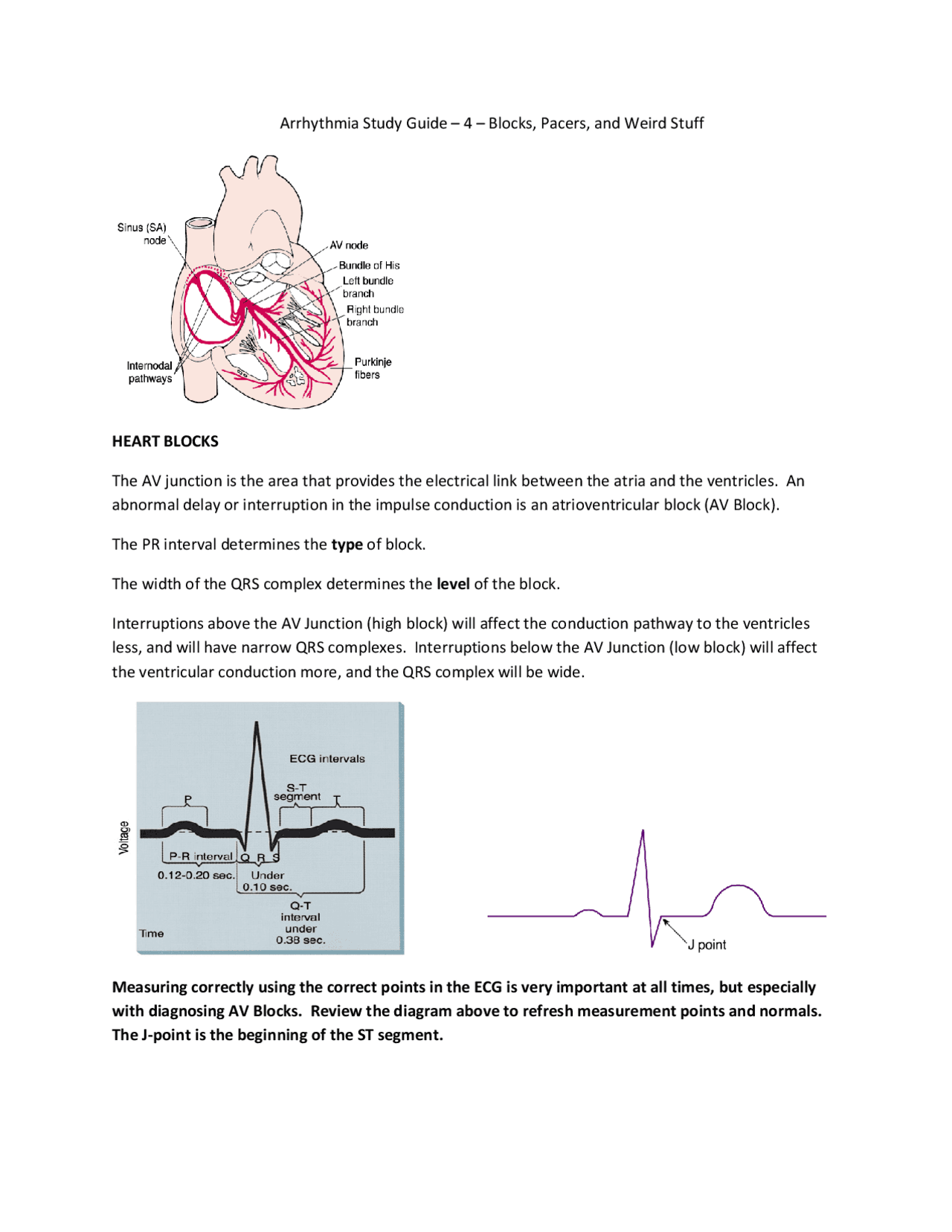 Arrhythmia Study Guide – 4 – Blocks, Pacers, and Weird Stuff | Study ...