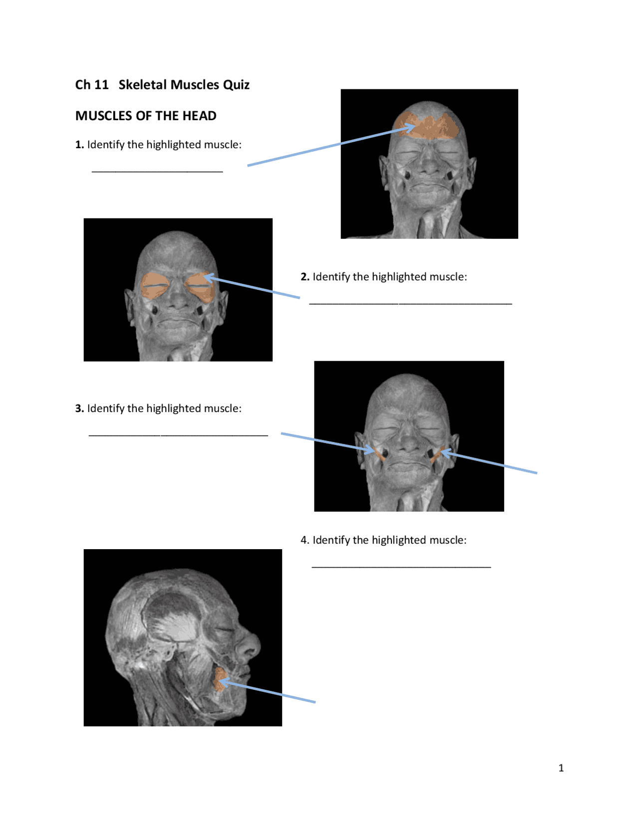 Ch 11 Skeletal Muscles Quiz MUSCLES OF THE HEAD Study notes Anatomy
