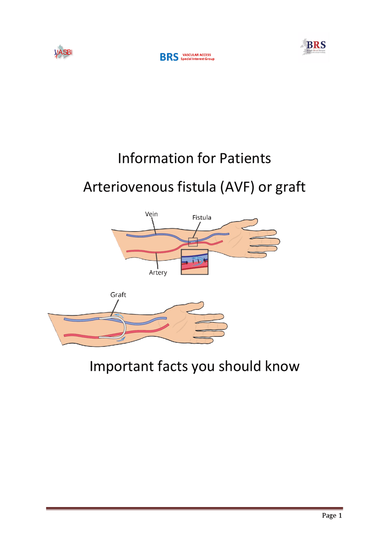 Information for Patients Arteriovenous fistula (AVF) or graft ...