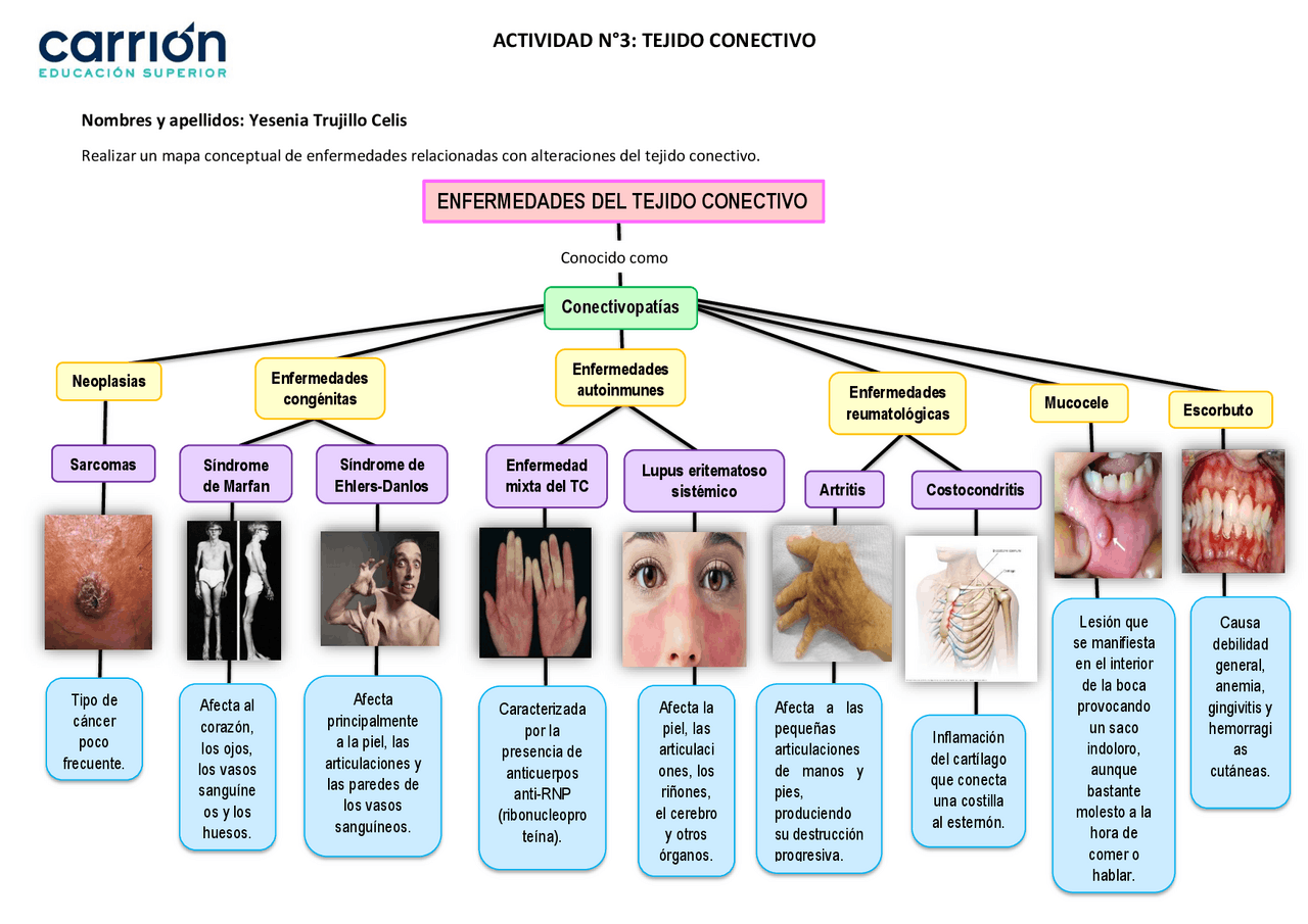 Mapa conceptual del tejido epitelial conectivo | Apuntes de Cultura