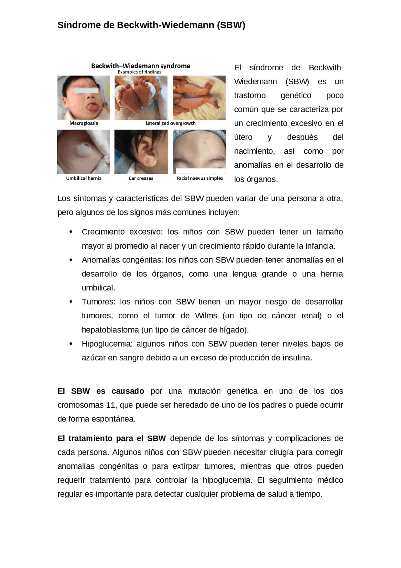 El síndrome de Beckwith-Wiedemann | Resúmenes de Genética | Docsity