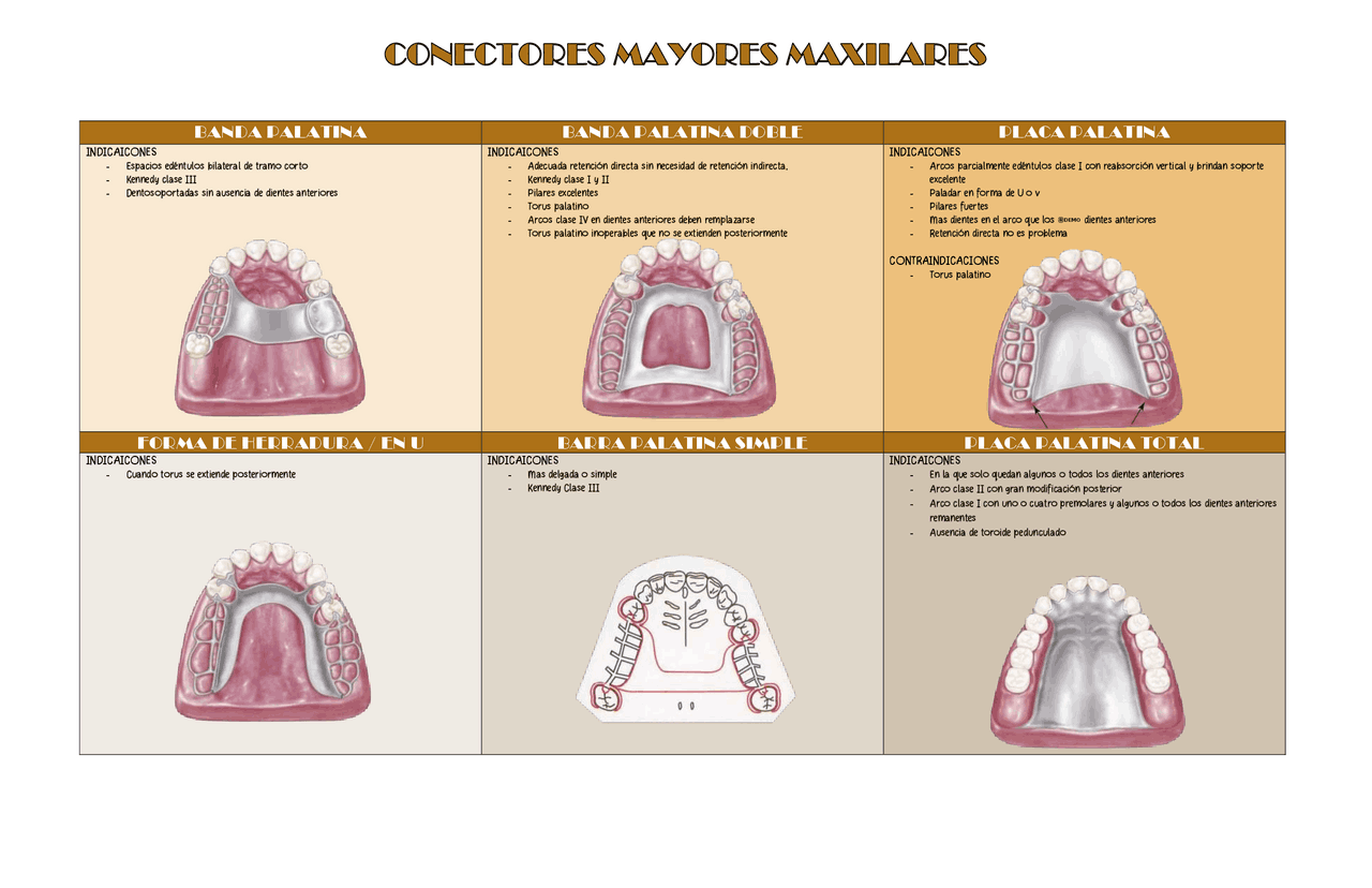 INDICACIONES Y CONTRAINDICACIONES DE LOS CONECTORES MAYORES EN PRÓTESIS