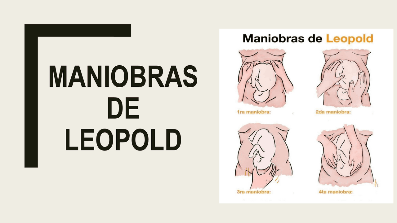 Maniobras de Leopold | Diapositivas de Ginecología | Docsity